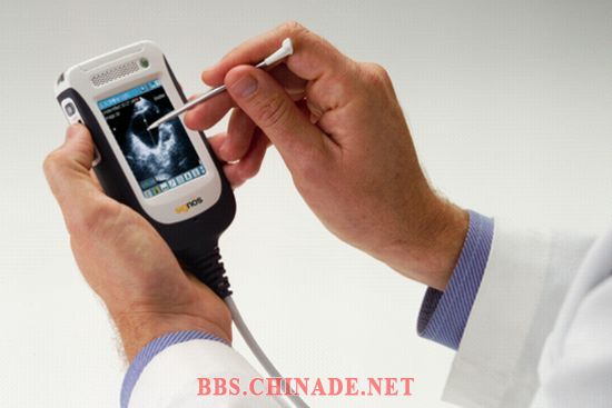 personal-ultrasound-3.jpg